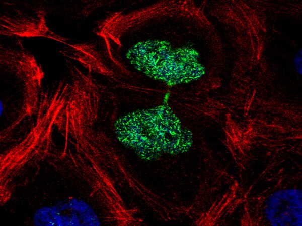 Gfp Rad51 LentiBrite™ GFP-Rad51 Lentiviral Biosensor | 17-10234